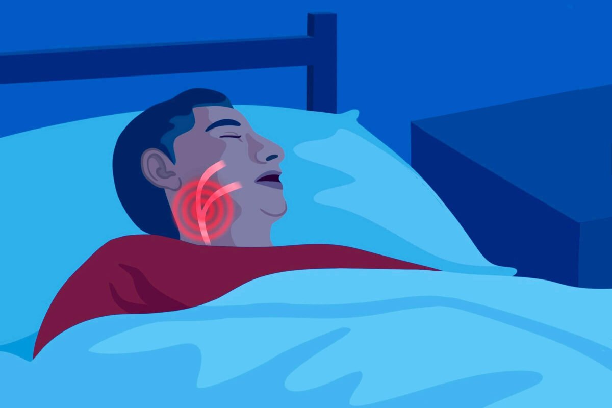 Sleep Apnea